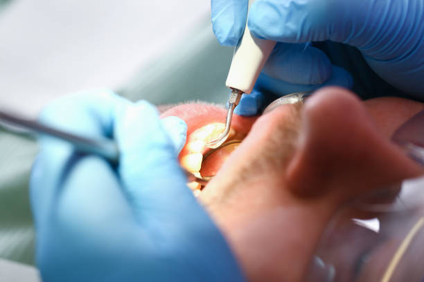 Best After-Hours Dental Trauma Care in Temple, GA