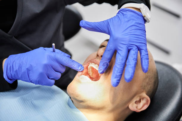 Best Emergency Tooth Extraction in Temple, GA